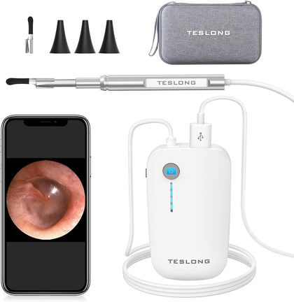 Teslong Digital Otoscope with Ear Wax Remover, Teslong Ear Camera with Ear Wax Removal Tools, Video Ear Scope Otoscope with Light for iPhone, iPad, Android Phone, USB, Ear Picks